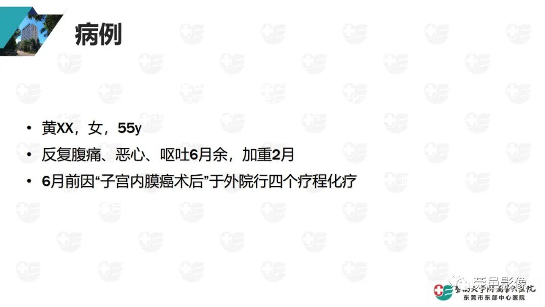 影像PPT - 【PPT】肠壁积气-2