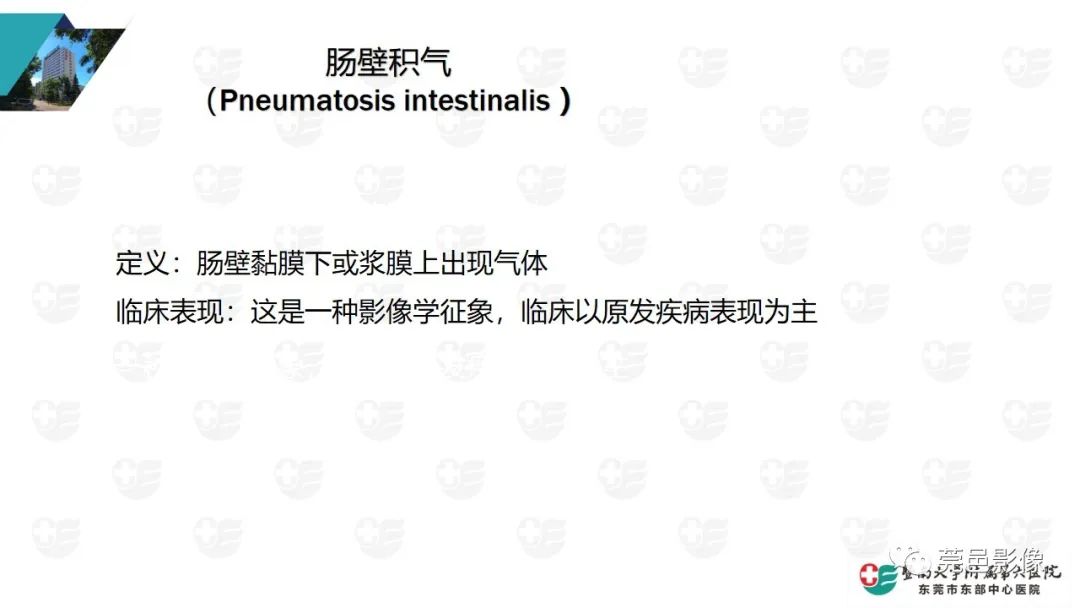 影像PPT - 【PPT】肠壁积气-5