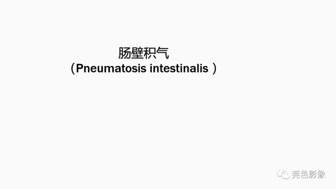 影像PPT - 【PPT】肠壁积气-4