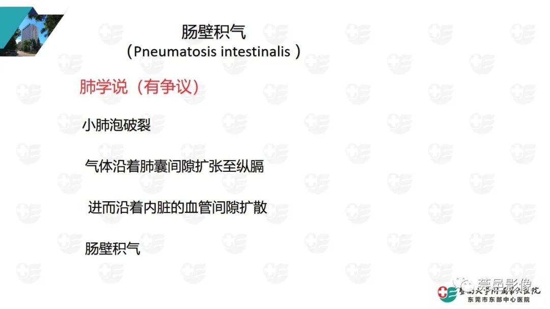 影像PPT - 【PPT】肠壁积气-12