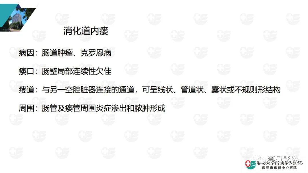 影像PPT - 【PPT】肠壁积气-30
