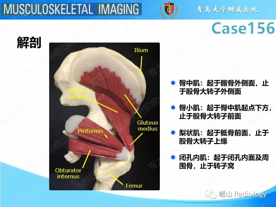 影像PPT - 【PPT】臀中肌及臀小肌肌腱撕裂-17
