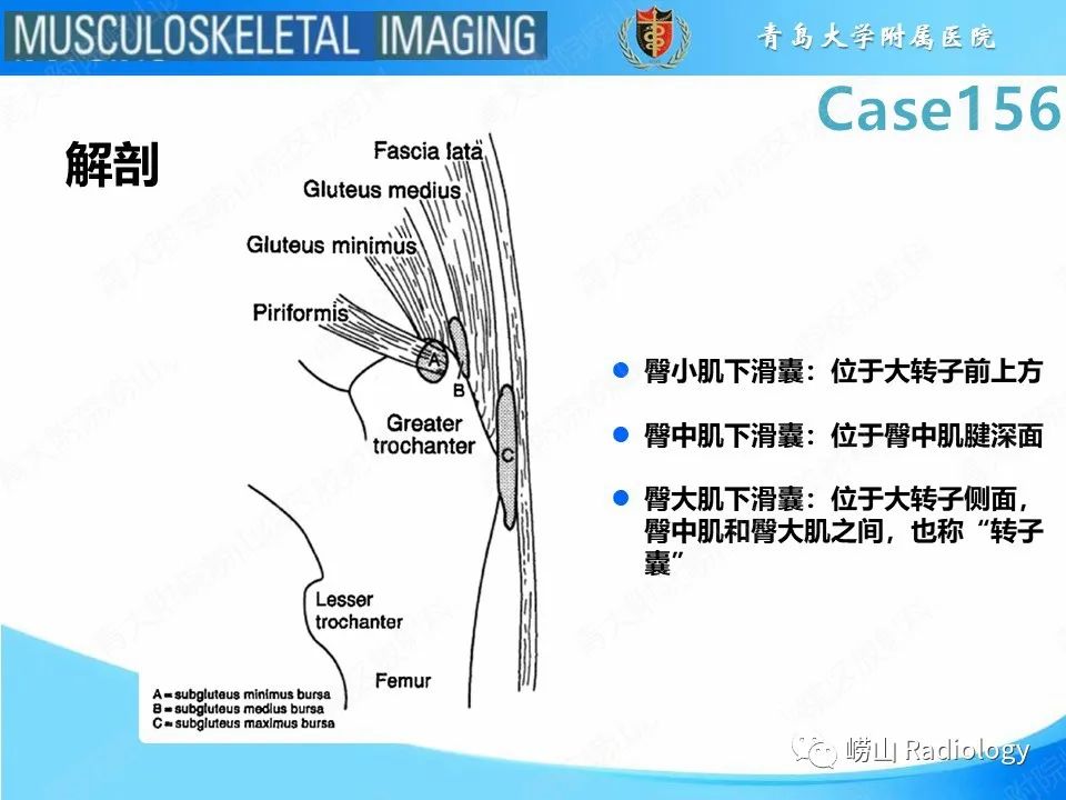 影像PPT - 【PPT】臀中肌及臀小肌肌腱撕裂-18