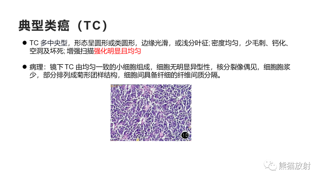 影像PPT - 【病例】肺大细胞神经内分泌癌2例CT影像-25