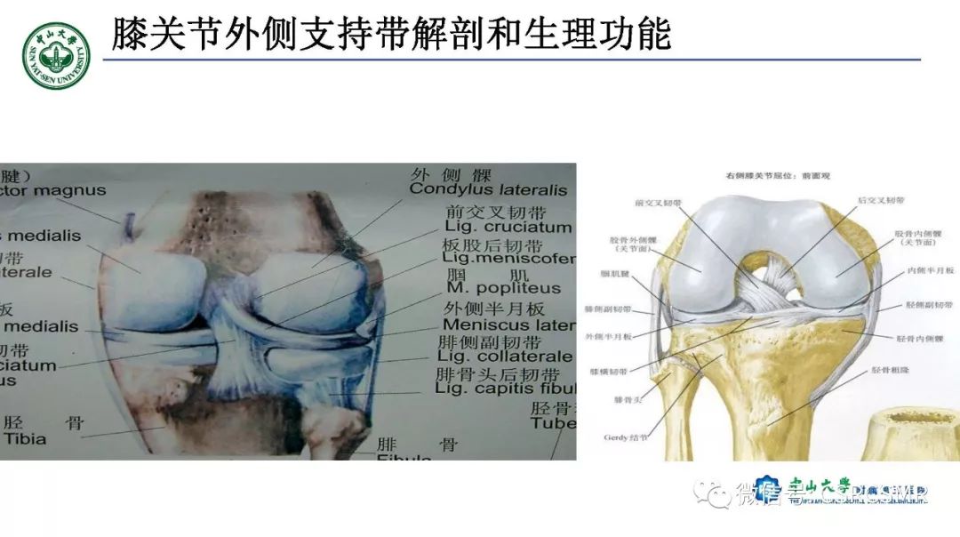 影像PPT - 【PPT】膝关节后外侧角区影像解剖及损伤后影像学诊断-6