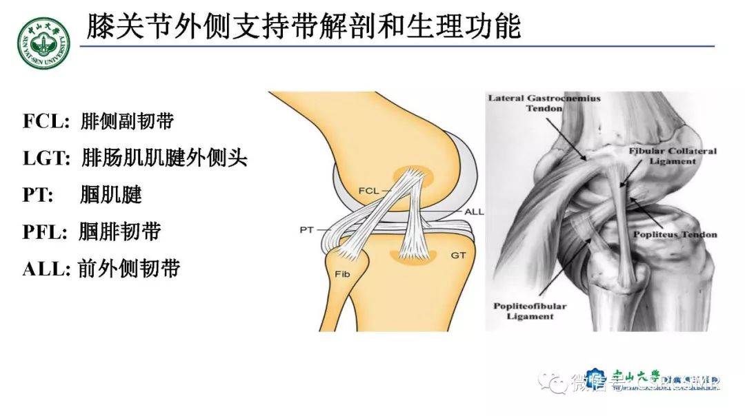 影像PPT - 【PPT】膝关节后外侧角区影像解剖及损伤后影像学诊断-7