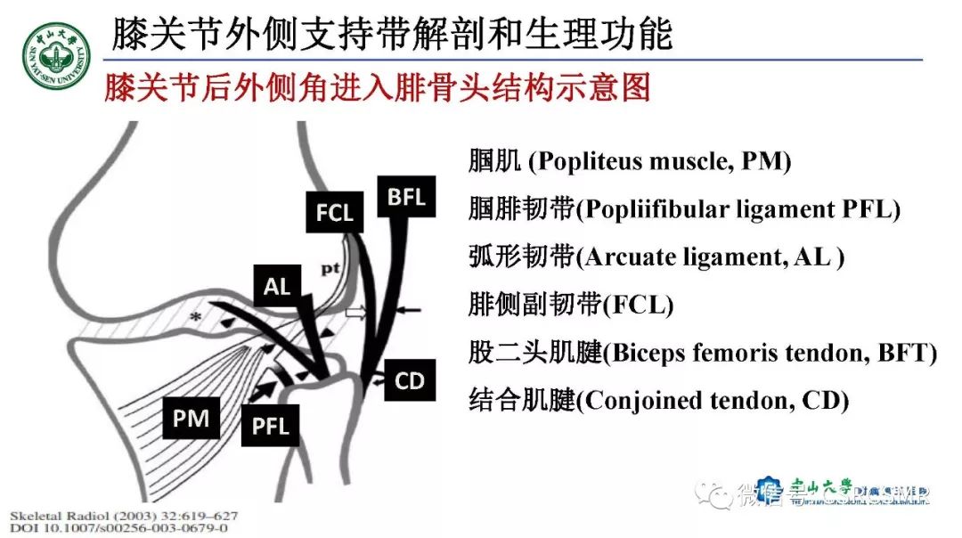 影像PPT - 【PPT】膝关节后外侧角区影像解剖及损伤后影像学诊断-8