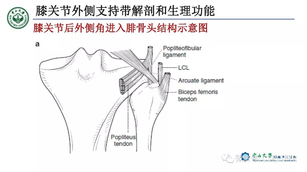 影像PPT - 【PPT】膝关节后外侧角区影像解剖及损伤后影像学诊断-9
