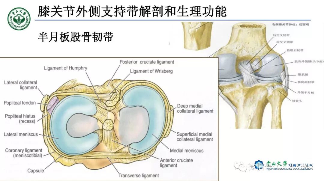 影像PPT - 【PPT】膝关节后外侧角区影像解剖及损伤后影像学诊断-10