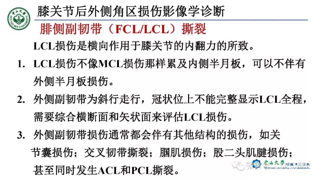 影像PPT - 【PPT】膝关节后外侧角区影像解剖及损伤后影像学诊断-24