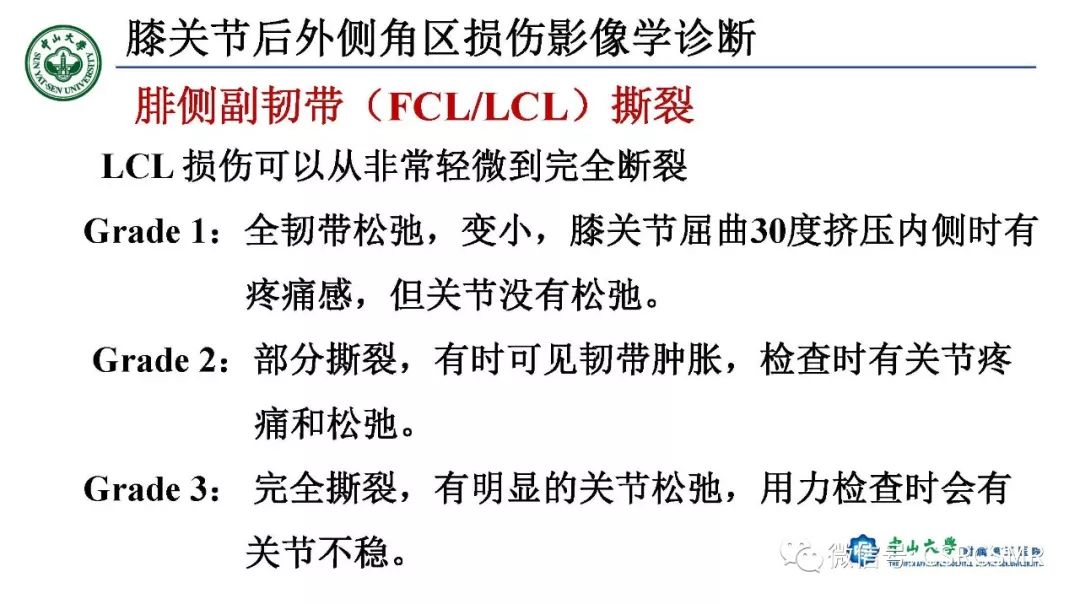 影像PPT - 【PPT】膝关节后外侧角区影像解剖及损伤后影像学诊断-25