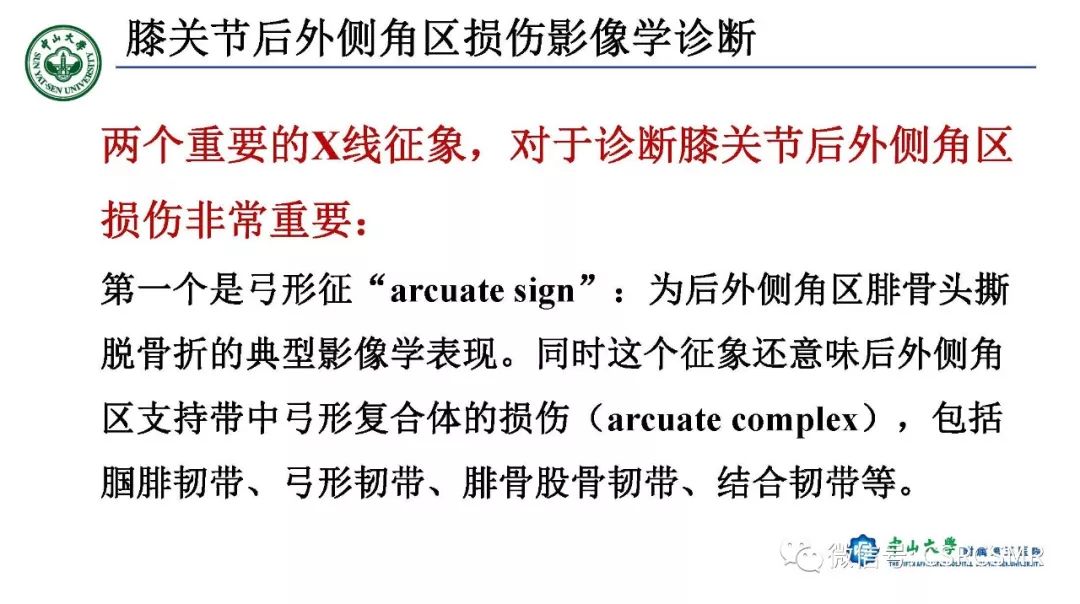 影像PPT - 【PPT】膝关节后外侧角区影像解剖及损伤后影像学诊断-36