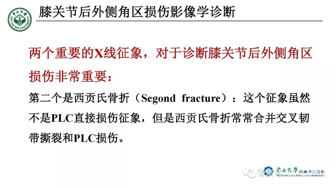 影像PPT - 【PPT】膝关节后外侧角区影像解剖及损伤后影像学诊断-37