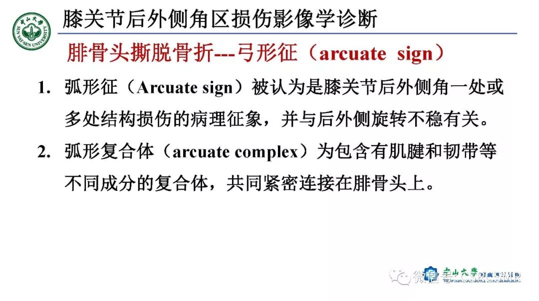 影像PPT - 【PPT】膝关节后外侧角区影像解剖及损伤后影像学诊断-43