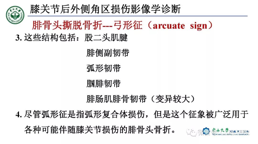 影像PPT - 【PPT】膝关节后外侧角区影像解剖及损伤后影像学诊断-44