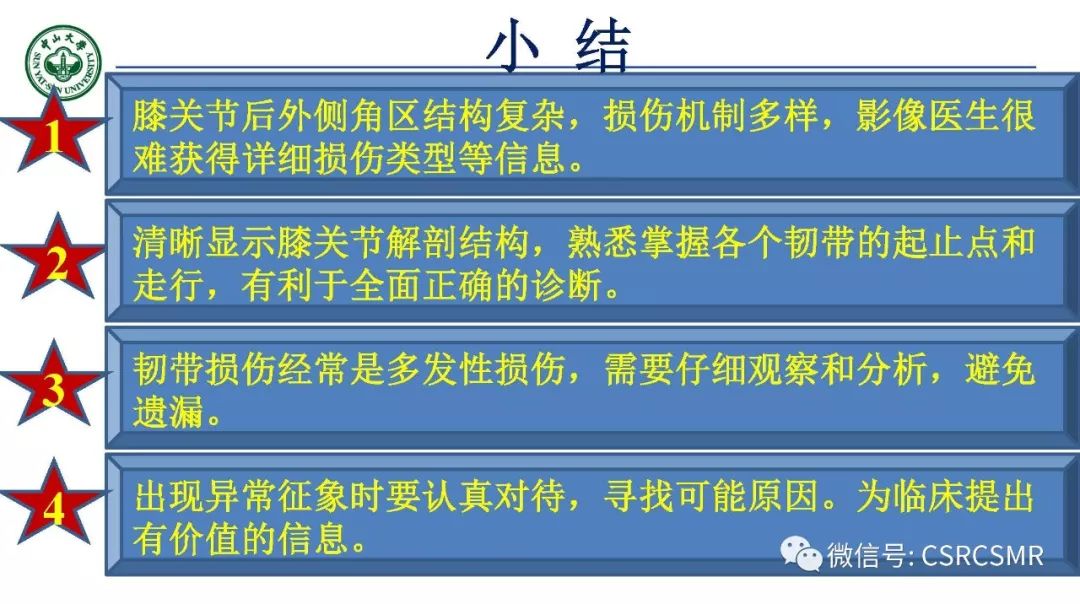 影像PPT - 【PPT】膝关节后外侧角区影像解剖及损伤后影像学诊断-48
