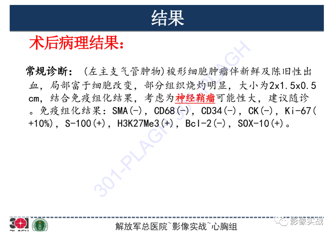影像PPT - 【病例】支气管神经鞘瘤1例CT影像-23