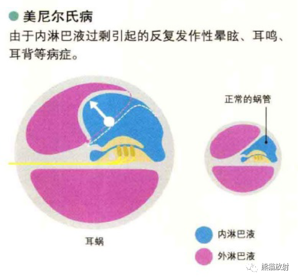 影像PPT - 耳、鼻、咽喉解剖-10