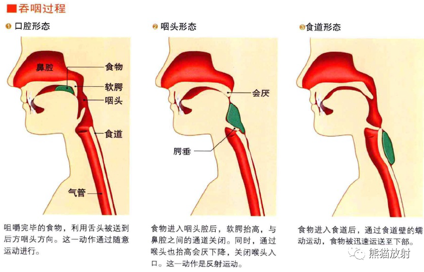 影像PPT - 耳、鼻、咽喉解剖-20