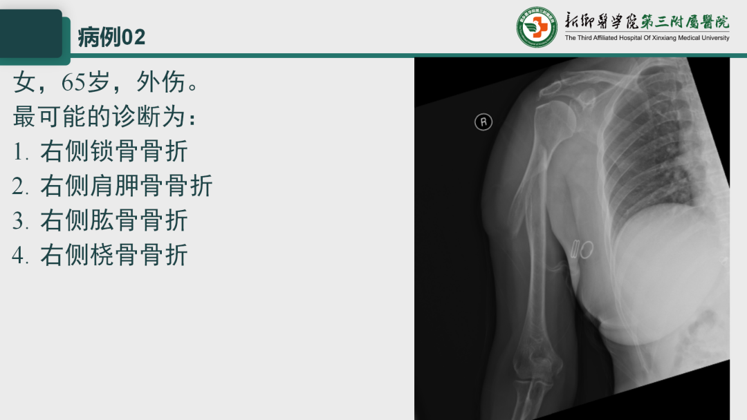 影像PPT - 【PPT】执业医师技能考试 影像篇·病例实训-7