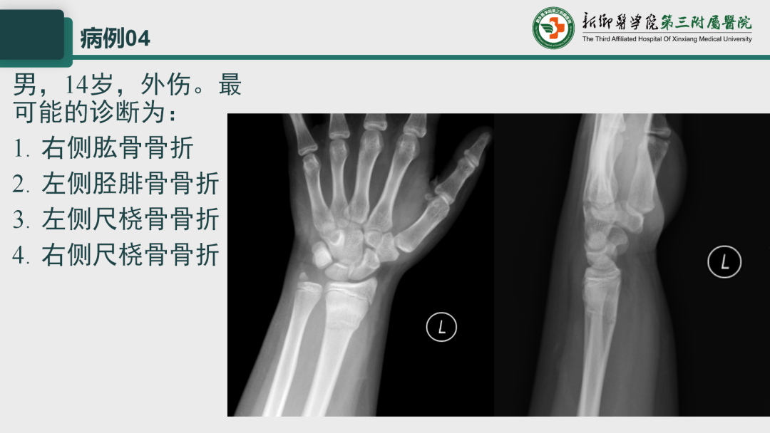 影像PPT - 【PPT】执业医师技能考试 影像篇·病例实训-9