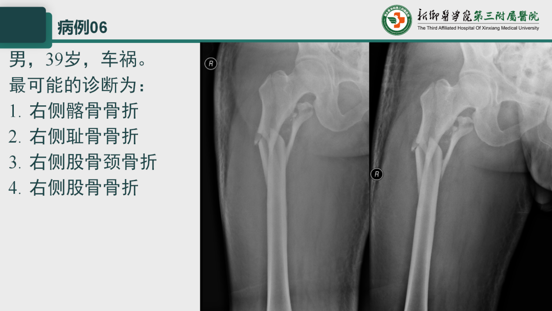 影像PPT - 【PPT】执业医师技能考试 影像篇·病例实训-11