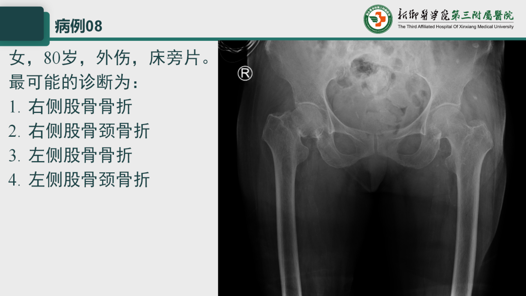 影像PPT - 【PPT】执业医师技能考试 影像篇·病例实训-13