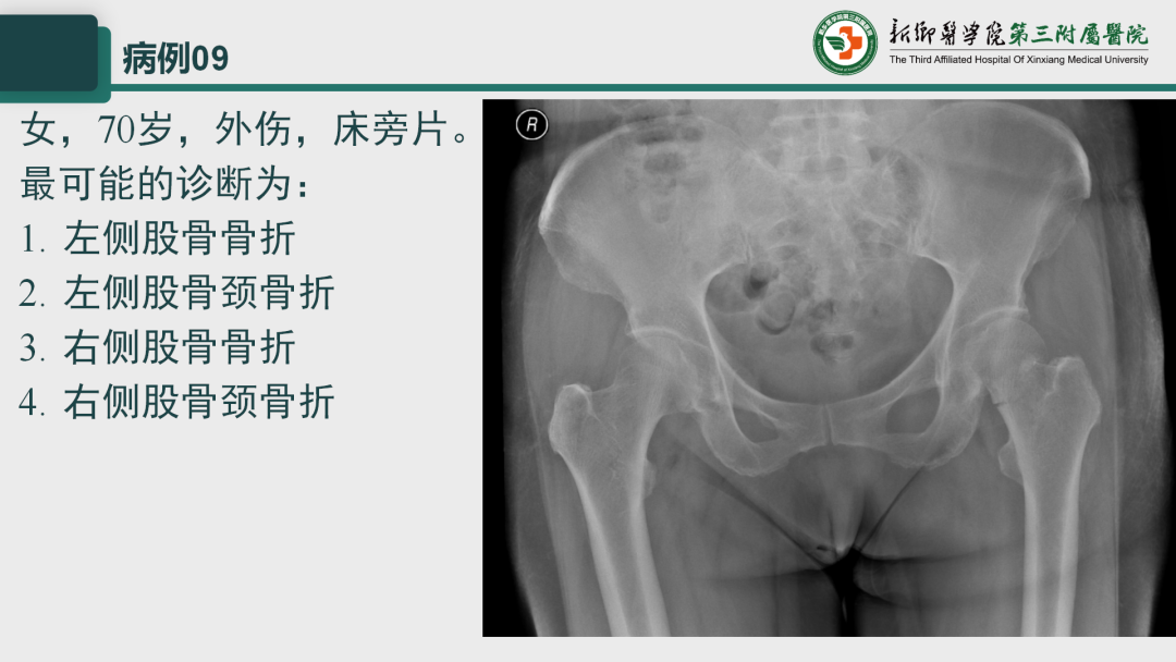 影像PPT - 【PPT】执业医师技能考试 影像篇·病例实训-14