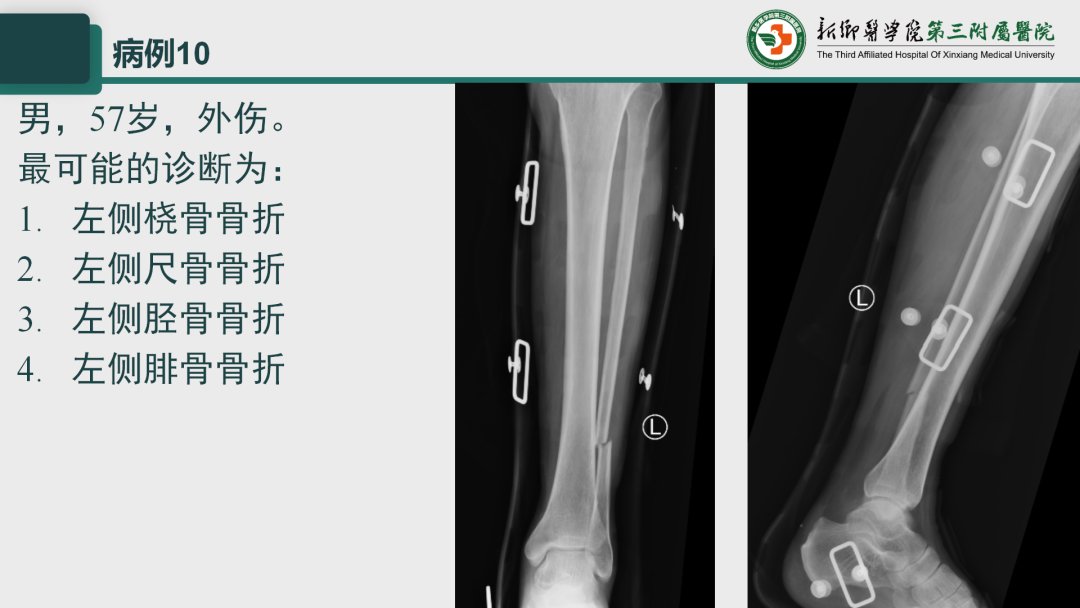 影像PPT - 【PPT】执业医师技能考试 影像篇·病例实训-15