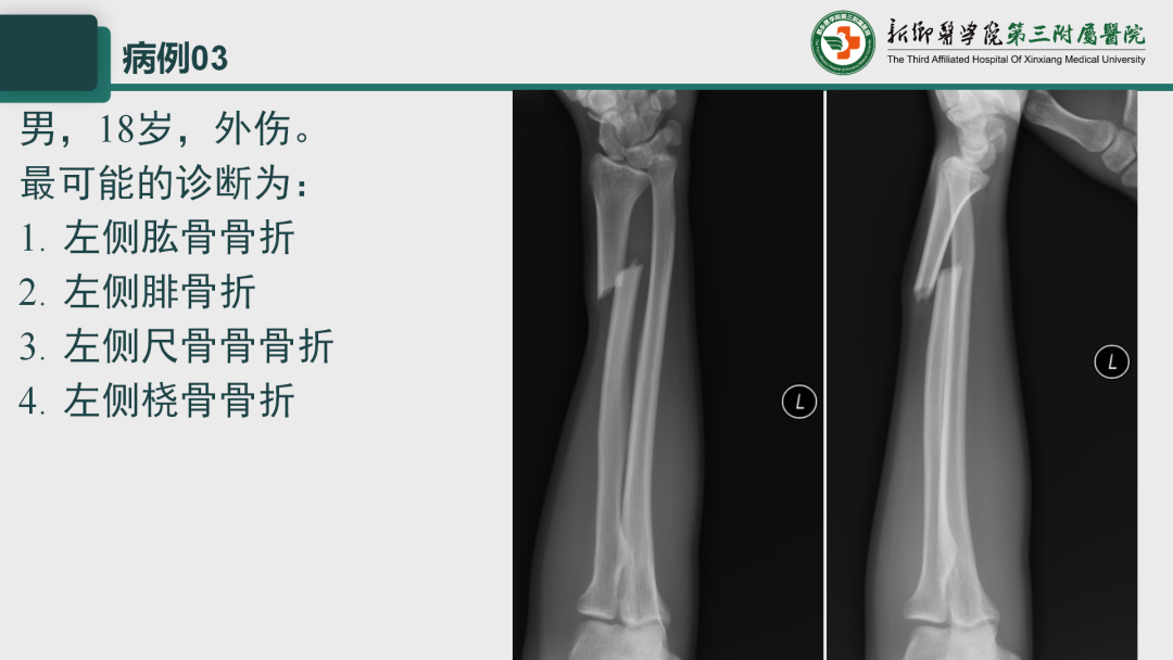 影像PPT - 【PPT】执业医师技能考试 影像篇·病例实训-8