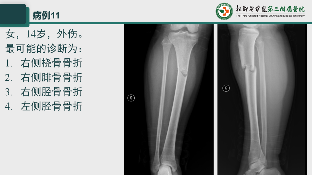 影像PPT - 【PPT】执业医师技能考试 影像篇·病例实训-16