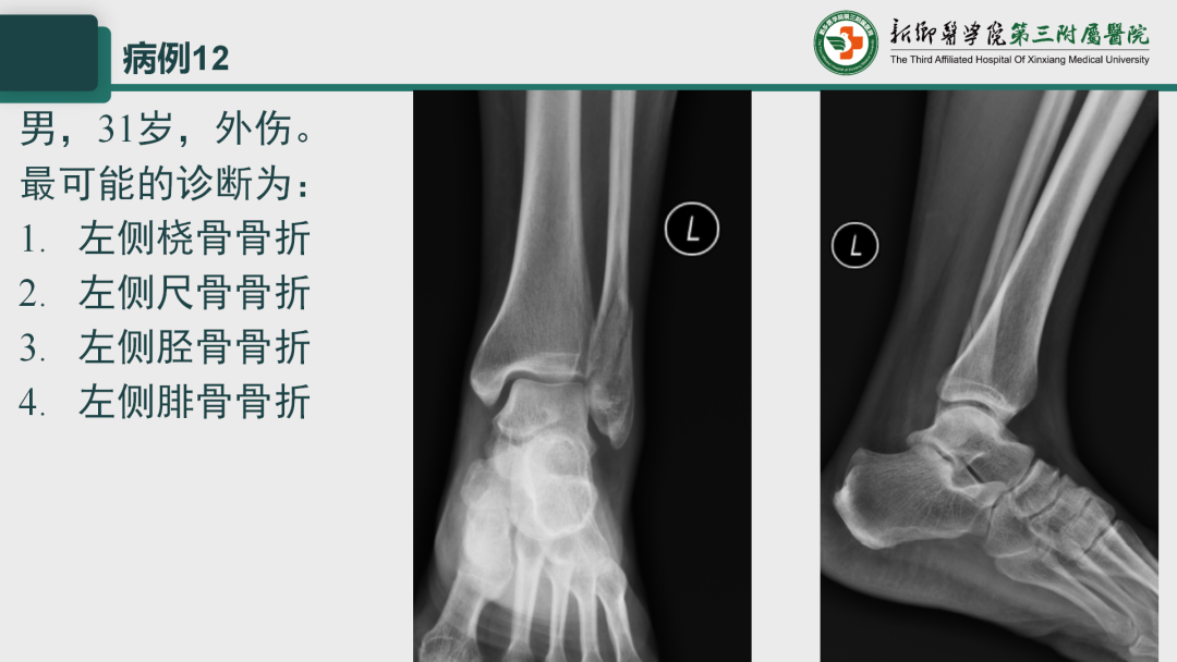 影像PPT - 【PPT】执业医师技能考试 影像篇·病例实训-17