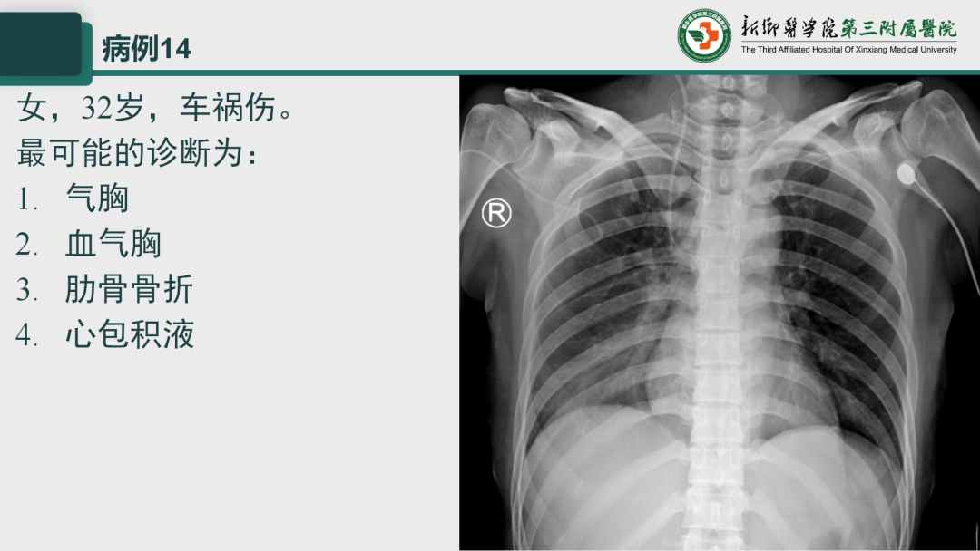 影像PPT - 【PPT】执业医师技能考试 影像篇·病例实训-20
