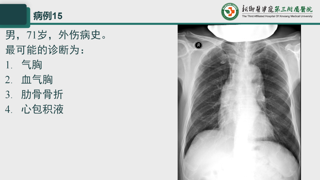 影像PPT - 【PPT】执业医师技能考试 影像篇·病例实训-21