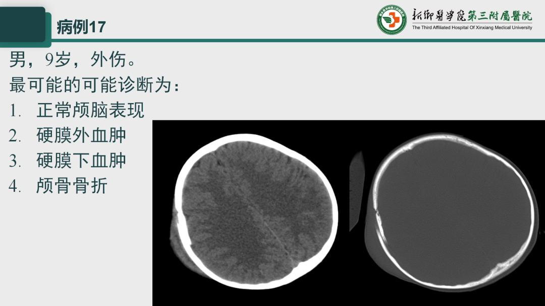 影像PPT - 【PPT】执业医师技能考试 影像篇·病例实训-24