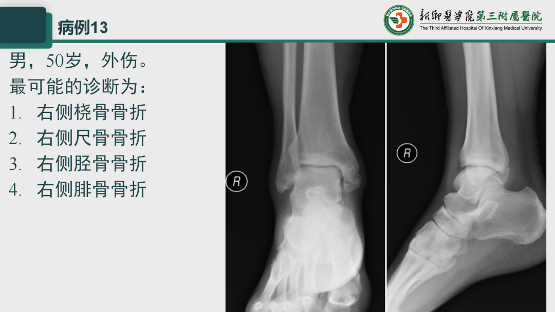 影像PPT - 【PPT】执业医师技能考试 影像篇·病例实训-18