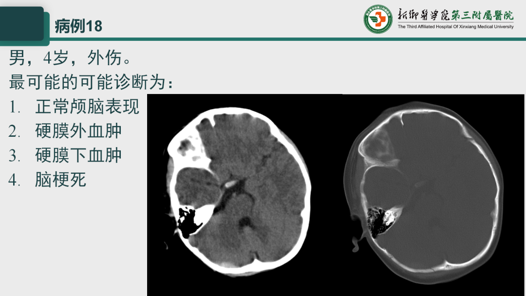 影像PPT - 【PPT】执业医师技能考试 影像篇·病例实训-25