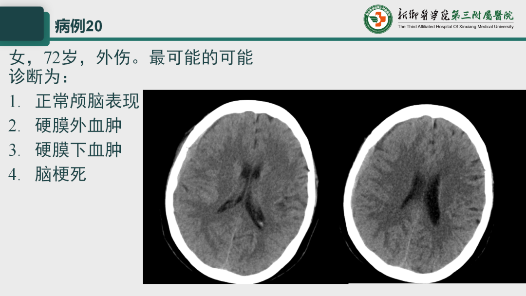 影像PPT - 【PPT】执业医师技能考试 影像篇·病例实训-27