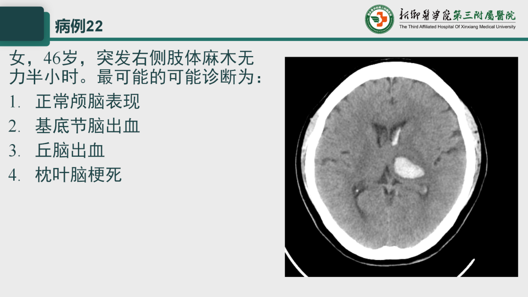 影像PPT - 【PPT】执业医师技能考试 影像篇·病例实训-29