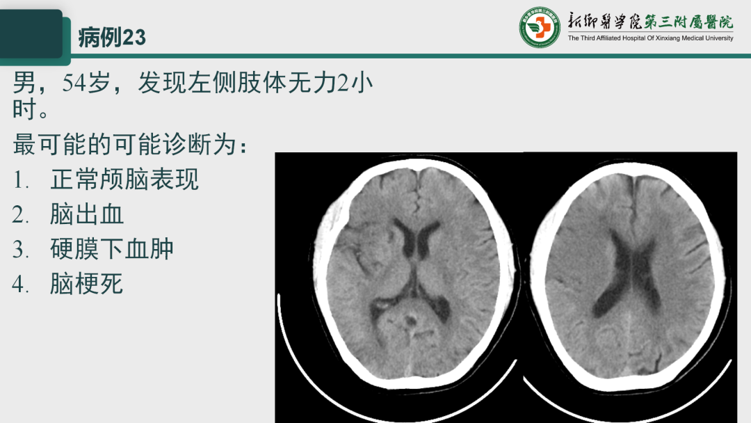 影像PPT - 【PPT】执业医师技能考试 影像篇·病例实训-30