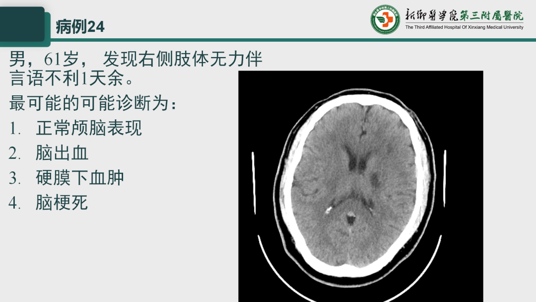 影像PPT - 【PPT】执业医师技能考试 影像篇·病例实训-31