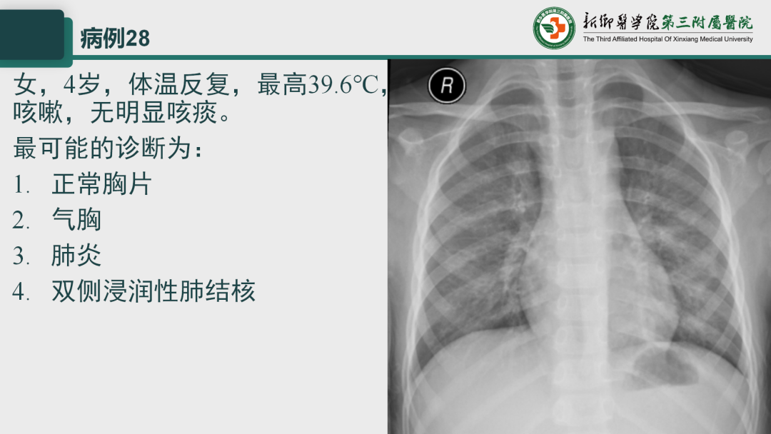 影像PPT - 【PPT】执业医师技能考试 影像篇·病例实训-36