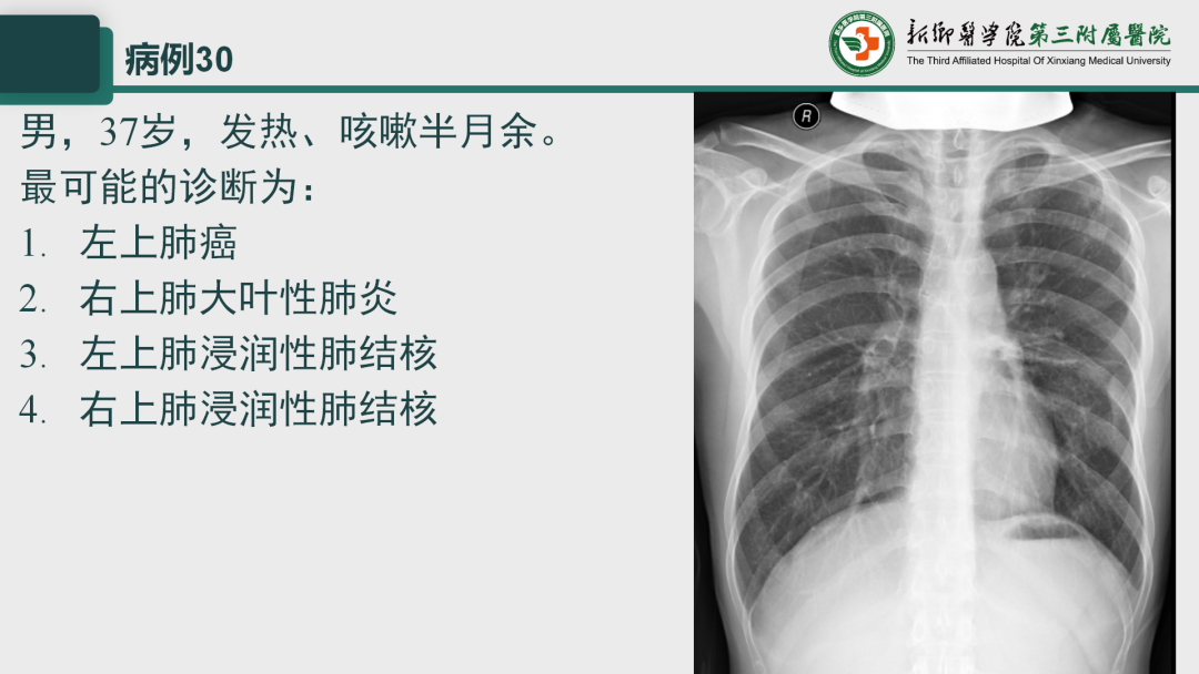 影像PPT - 【PPT】执业医师技能考试 影像篇·病例实训-38