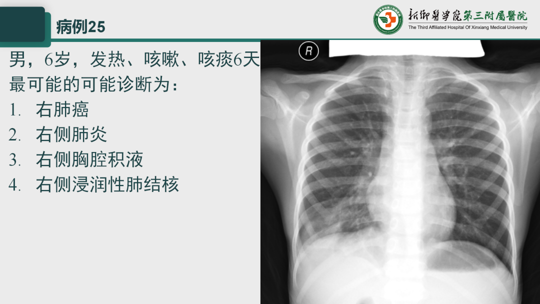 影像PPT - 【PPT】执业医师技能考试 影像篇·病例实训-33