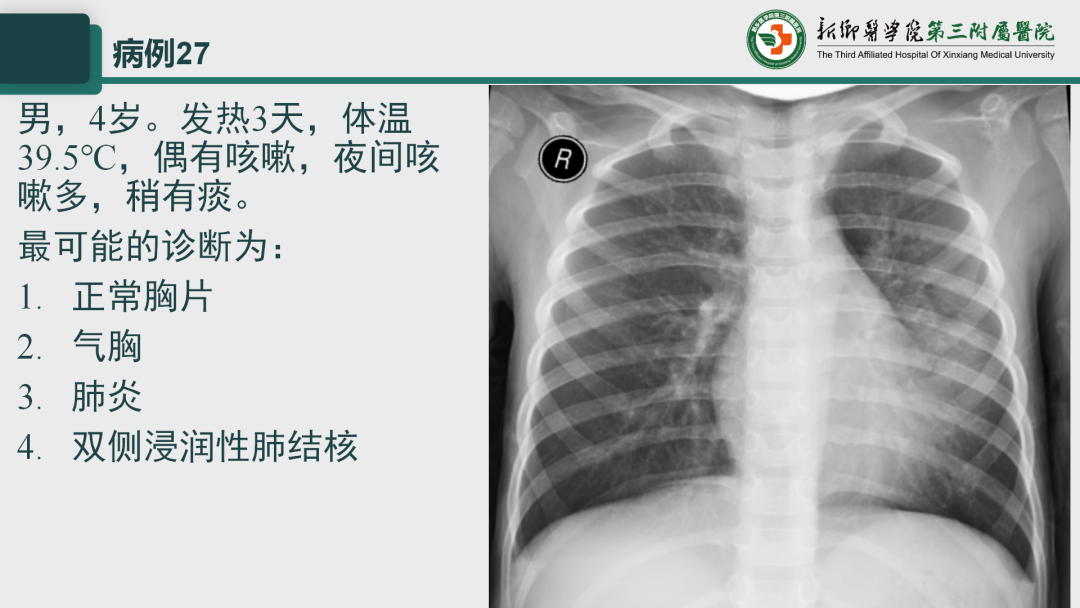 影像PPT - 【PPT】执业医师技能考试 影像篇·病例实训-35