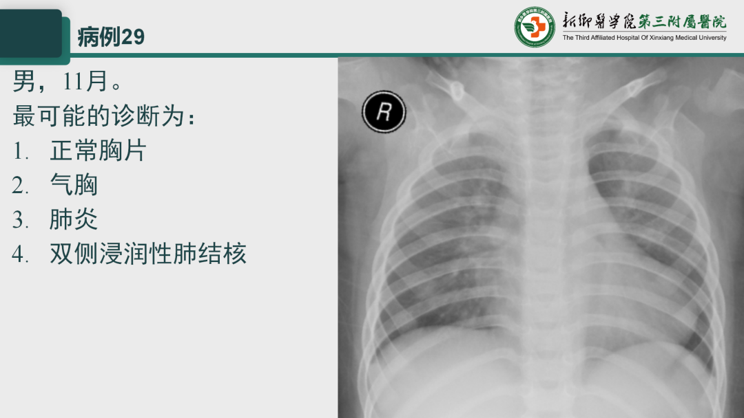 影像PPT - 【PPT】执业医师技能考试 影像篇·病例实训-37