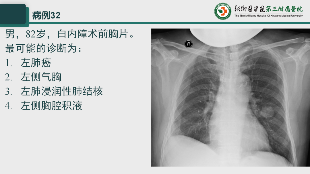 影像PPT - 【PPT】执业医师技能考试 影像篇·病例实训-40