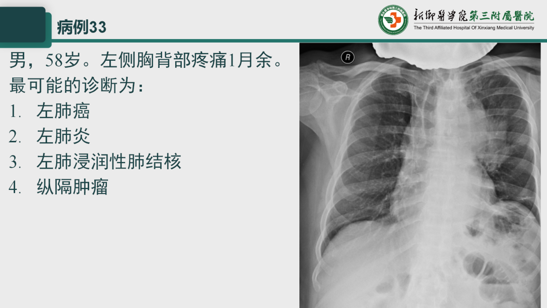 影像PPT - 【PPT】执业医师技能考试 影像篇·病例实训-41