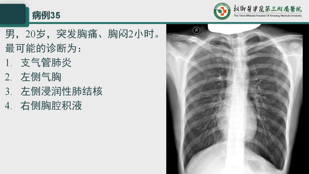 影像PPT - 【PPT】执业医师技能考试 影像篇·病例实训-43