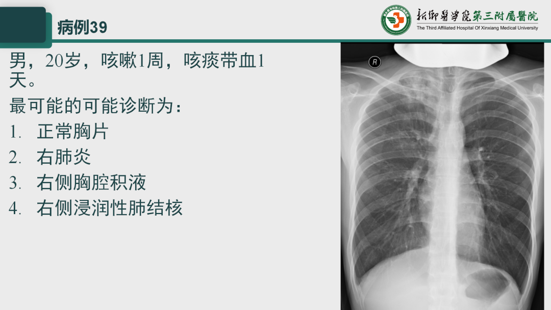 影像PPT - 【PPT】执业医师技能考试 影像篇·病例实训-47